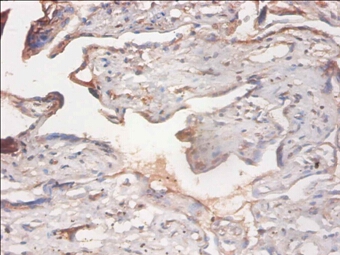 PHD finger-like domain-containing protein 5A Polyclonal Antibody