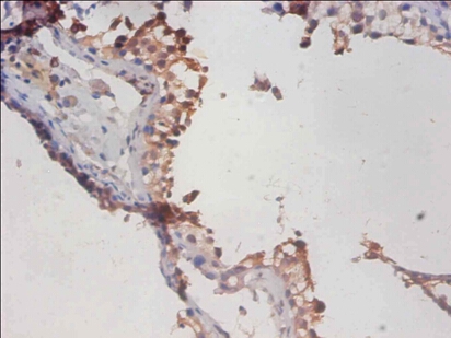 PHD finger-like domain-containing protein 5A Polyclonal Antibody
