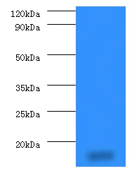 14 kDa phosphohistidine phosphatase Polyclonal Antibody