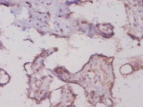 Glycogen phosphorylase, liver form Polyclonal Antibody