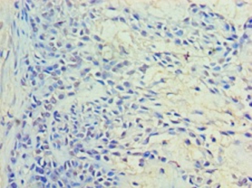 Ras-related protein Rab-11A Polyclonal Antibody