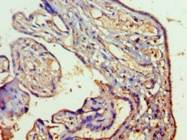 Ras-related protein Rab-5A Polyclonal Antibody