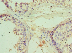 RNF8 Polyclonal Antibody