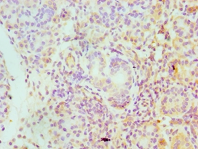 SERPINA4 Polyclonal Antibody