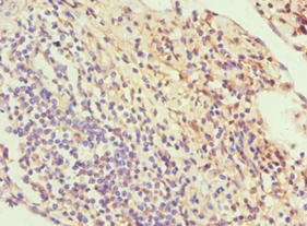 SLC2A1 Polyclonal Antibody