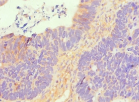 SLC2A1 Polyclonal Antibody