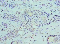SLURP1 Polyclonal Antibody