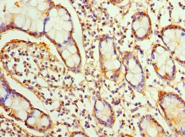 SRI Polyclonal Antibody