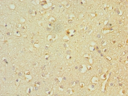 TACR3 Polyclonal Antibody