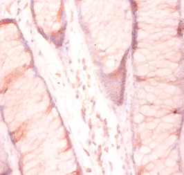 60S ribosomal protein L27 Polyclonal Antibody