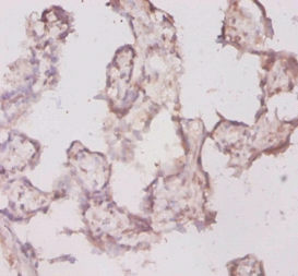 Translationally-controlled tumor Polyclonal Antibody