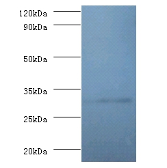 60S ribosomal protein L5 Polyclonal Antibody
