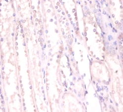 RNA-binding protein FUS Polyclonal Antibody