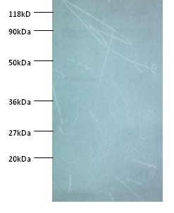 NADH dehydrogenase [ubiquinone] iron-sulfur protein 5 Polyclonal Antibody