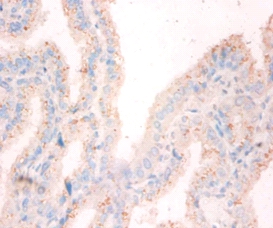 Nucleoside diphosphate kinase A Polyclonal Antibody