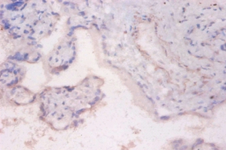 Ribosomal protein S6 kinase beta-2 Polyclonal Antibody