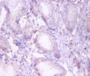 Trifunctional enzyme subunit beta, mitochondrial Polyclonal Antibody