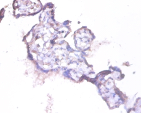 HCLS1-associated protein X-1 Polyclonal Antibody