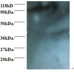 HCLS1-associated protein X-1 Polyclonal Antibody