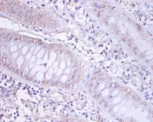 DnaJ homolog subfamily B member 1 Polyclonal Antibody