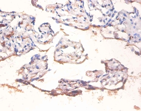 Transcription factor p65 Polyclonal Antibody