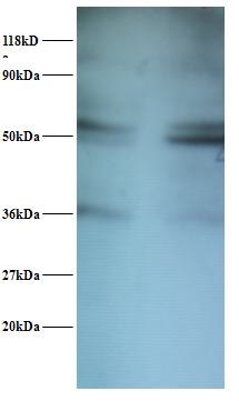 Seryl-tRNA synthetase, cytoplasmic Polyclonal Antibody