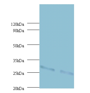 Cytochrome b-c1 complex subunit Rieske, mitochondrial Polyclonal Antibody