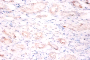 BTB/POZ domain-containing protein 2 Polyclonal Antibody
