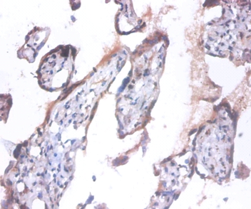Anaphase-promoting complex subunit 5 Polyclonal Antibody