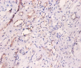 Myosin light polypeptide 6 Polyclonal Antibody