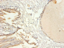 Transcription intermediary factor 1-beta Polyclonal Antibody