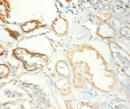 Transcription intermediary factor 1-beta Polyclonal Antibody