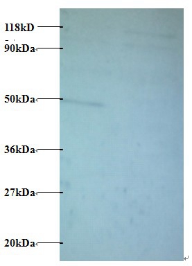 Protein AATF Polyclonal Antibody