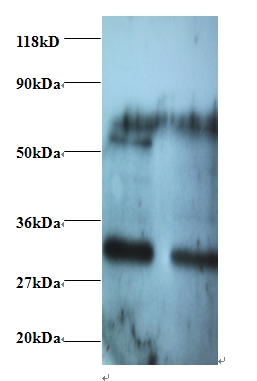 Rho guanine nucleotide exchange factor 18 Polyclonal Antibody