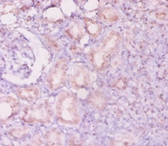 Angiopoietin-2 Polyclonal Antibody