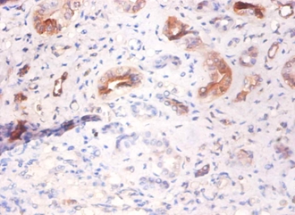 Alpha-2-HS-glycoprotein Polyclonal Antibody