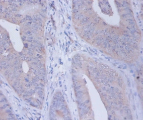 Interleukin-12 subunit beta Polyclonal Antibody