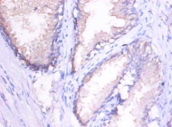 Interstitial collagenase Polyclonal Antibody