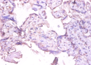 Interstitial collagenase Polyclonal Antibody