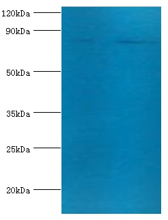 Transferrin receptor protein 1 Polyclonal Antibody