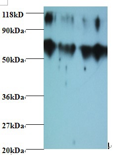 Metalloproteinase inhibitor 2 Polyclonal Antibody