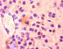 Fatty acid-binding protein, heart Polyclonal Antibody