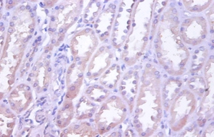 Tumor necrosis factor receptor superfamily member 10D Polyclonal Antibody