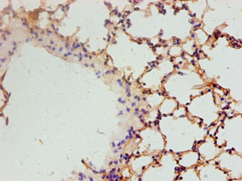 Vascular endothelial growth factor A Polyclonal Antibody