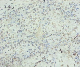 Interleukin-8 Polyclonal Antibody
