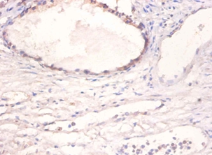 Bone morphogenetic protein 2 Polyclonal Antibody