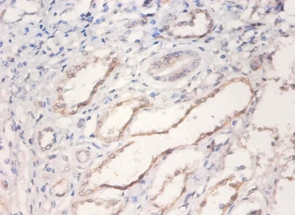 Bone morphogenetic protein 2 Polyclonal Antibody