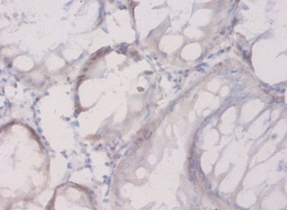 Connective tissue growth factor Polyclonal Antibody