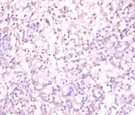 Substance-P receptor Polyclonal Antibody