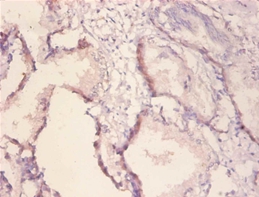 Receptor tyrosine-protein kinase erbB-2 Polyclonal Antibody